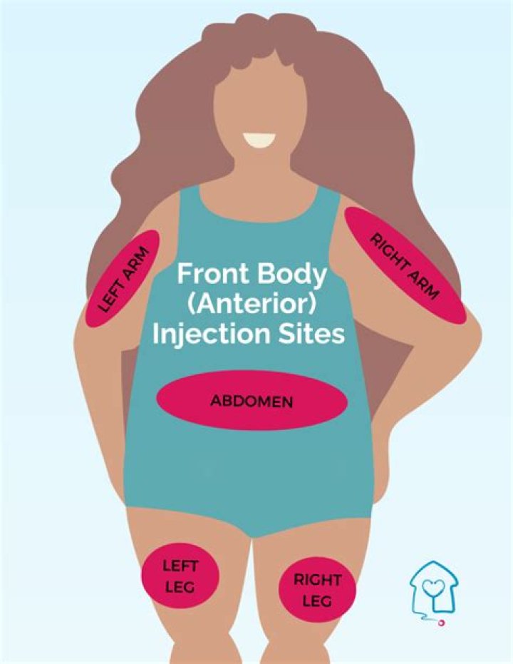 How often are you supposed to replace your underwear?